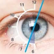 Kontaktlencse kontroll