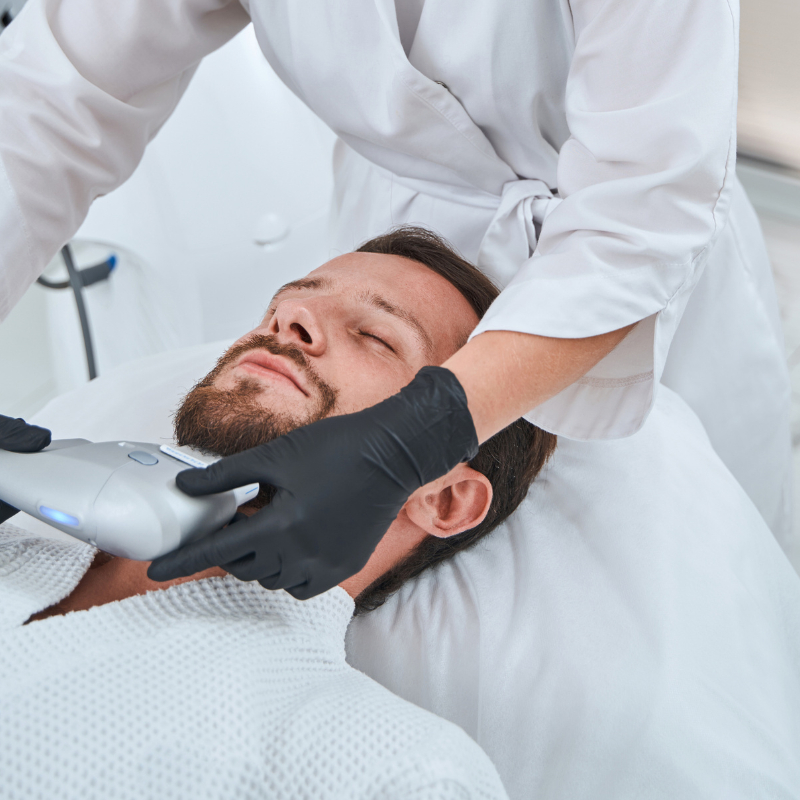 Depilação Laser SHR Barba +Pescoço (Homem)