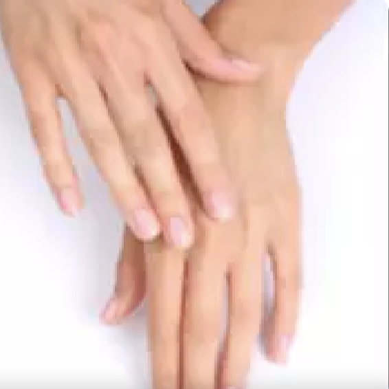 IPL odstranění pigmentace - celé ruce