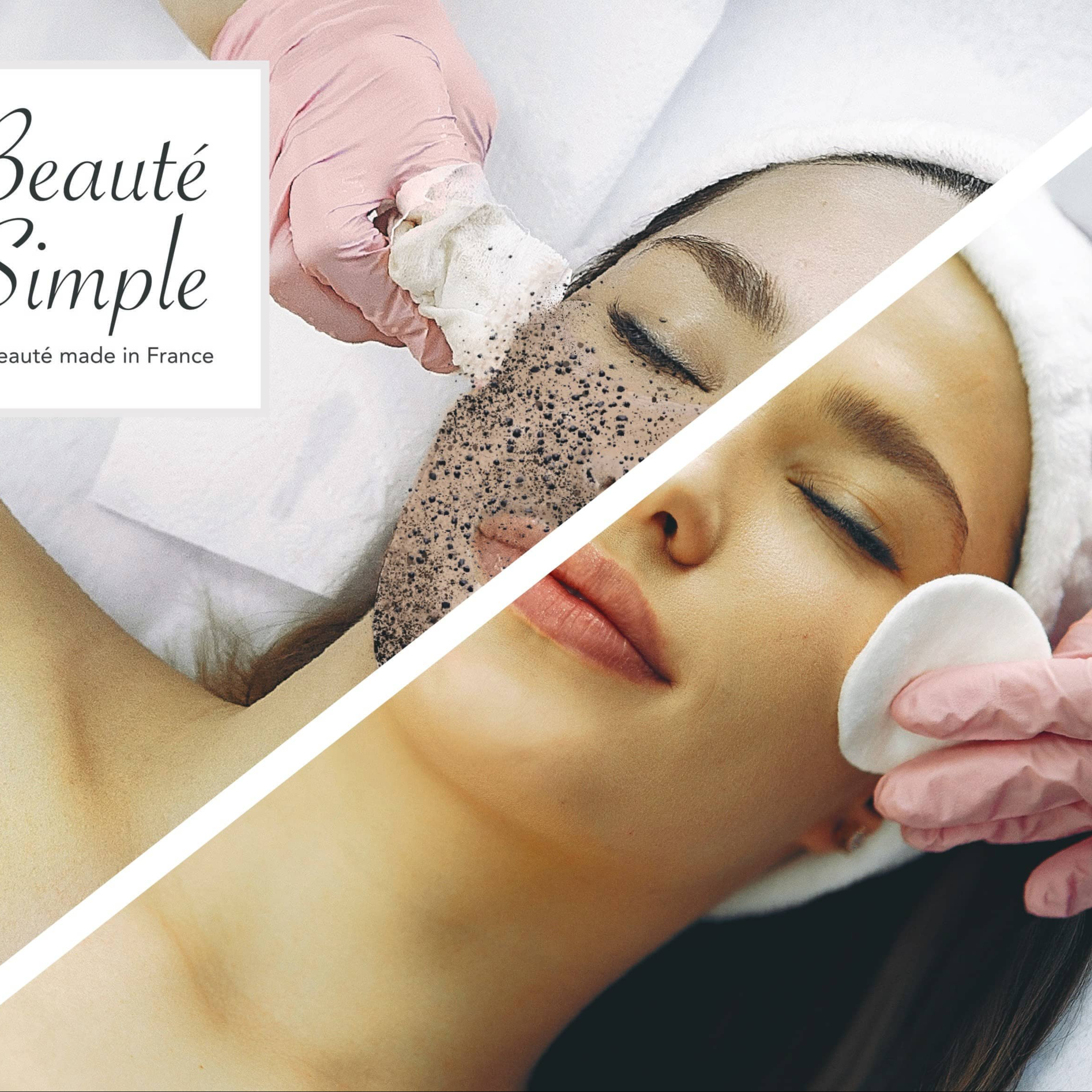 Supplément microdermabrasion végétale