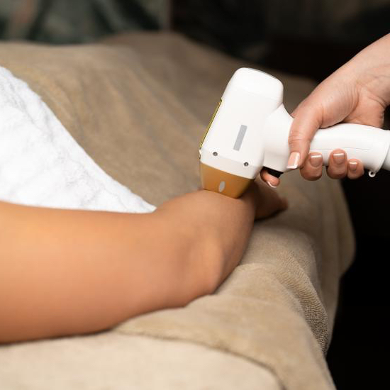 IPL epilace celé ruce