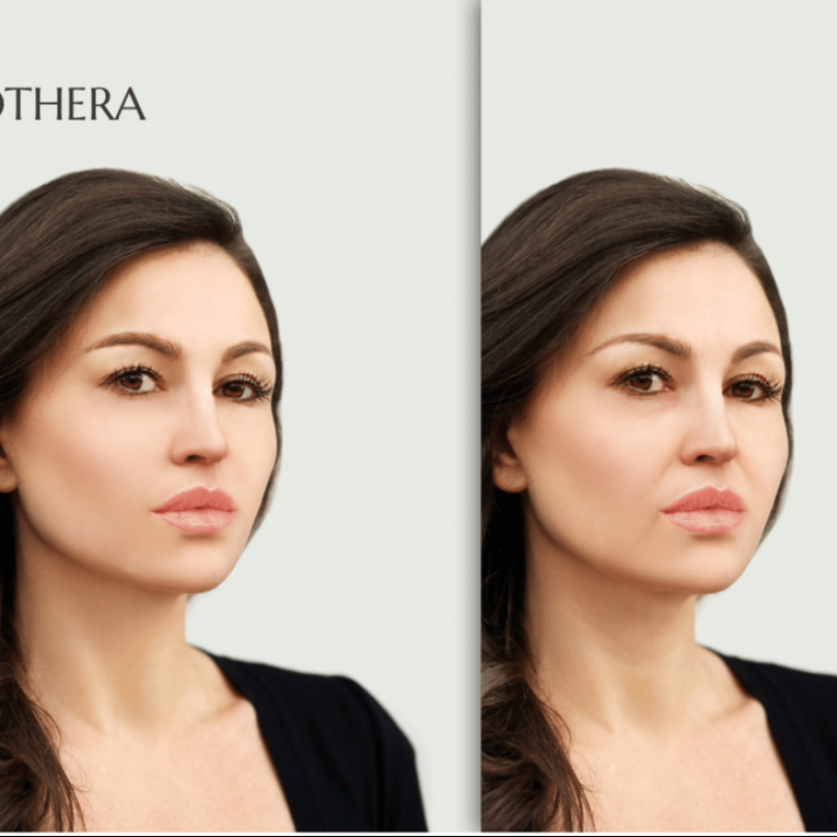 35+ ... BIOSTIMULÁTOROM