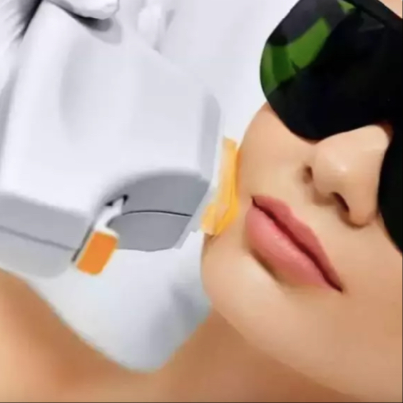 IPL Fotoomlazení obličej + krk + dekolt