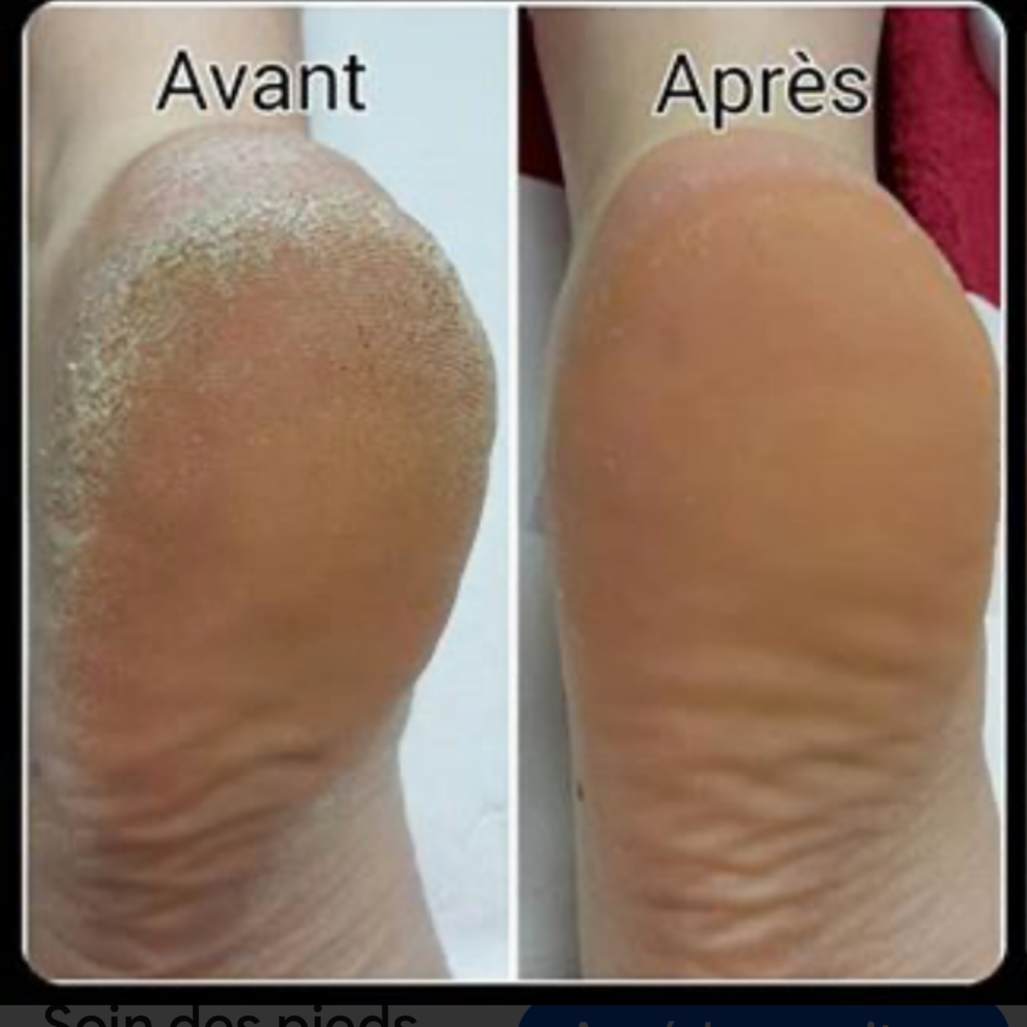 Soin Pieds Velours