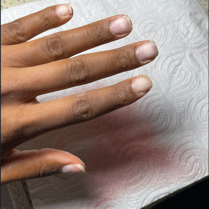 Une dépose du vernis semi-pemanent