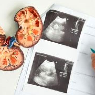 Visita Nefrologica con Ecografia Reni e Vie Urinarie