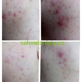 JUNIOR: ..čištění mladé, problematické pleti 60min. /800,-