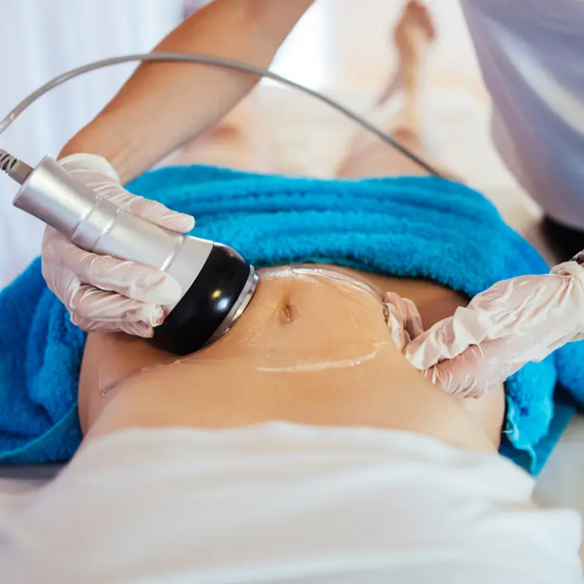 Skadi Sculpt /Body contouring buik