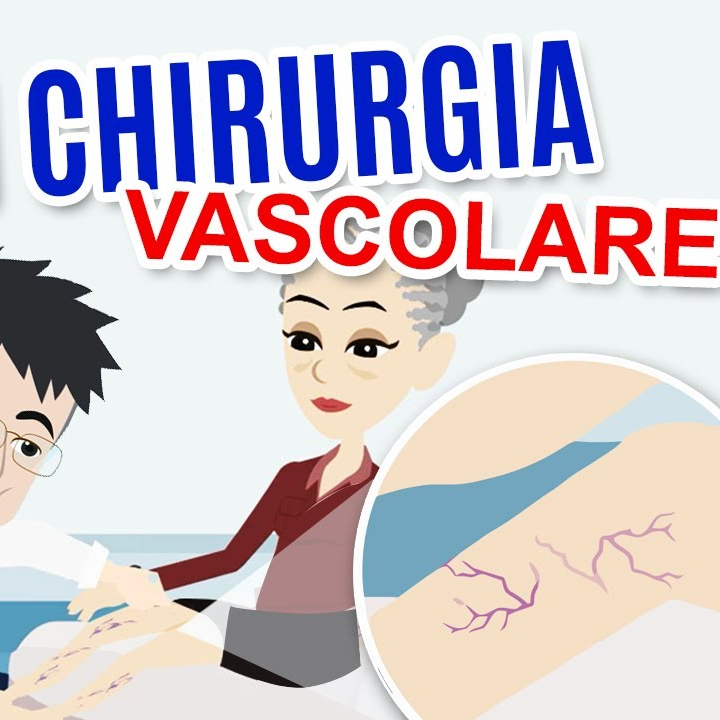 Visita Chirurgica Vascolare