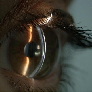 Follow-Up After Contact Lens Fitting