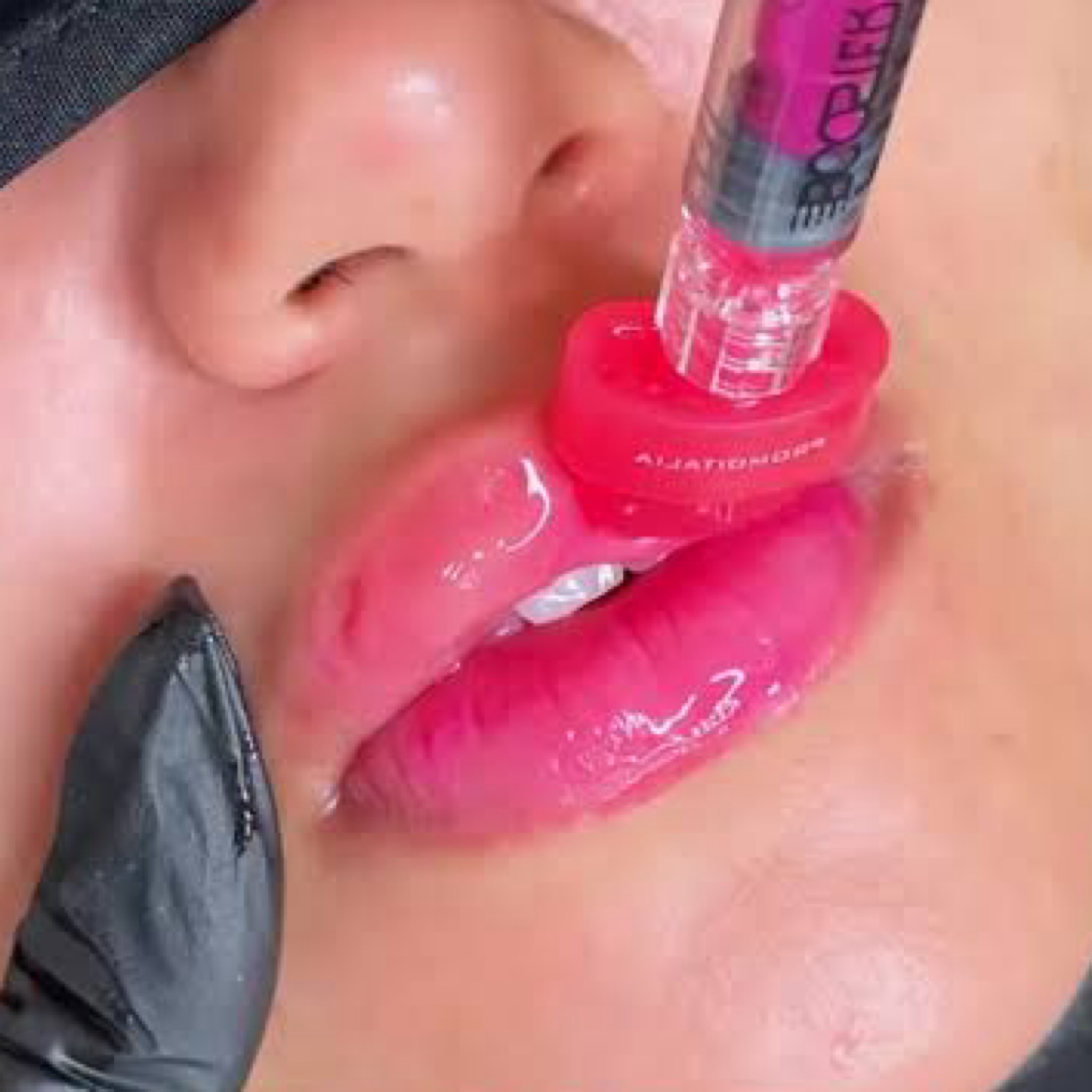 Lip Booster - revitalizace rtů