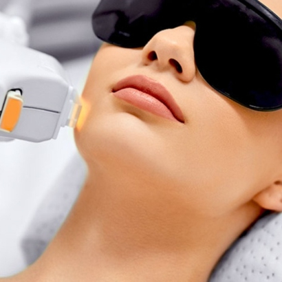 Depilação Laser SHR Queixo