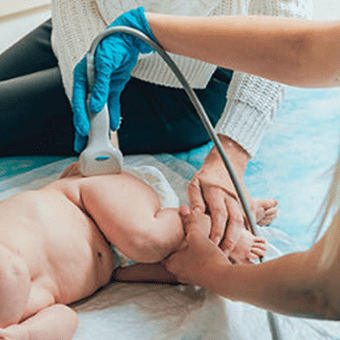 Anche del neonato (screening displasia anca)