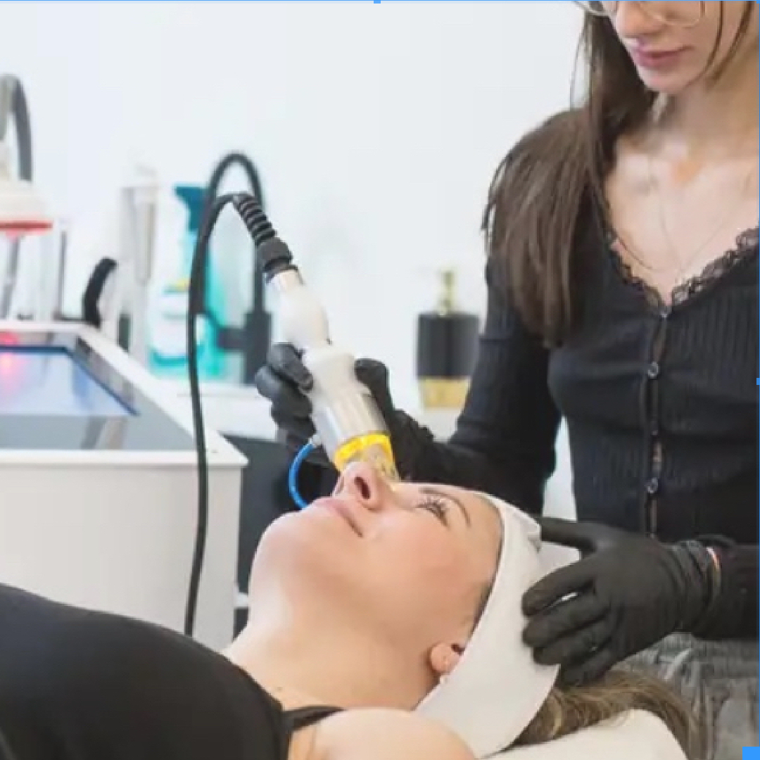 Mikroihličková frakčná Rádiofrekvencia - tvár