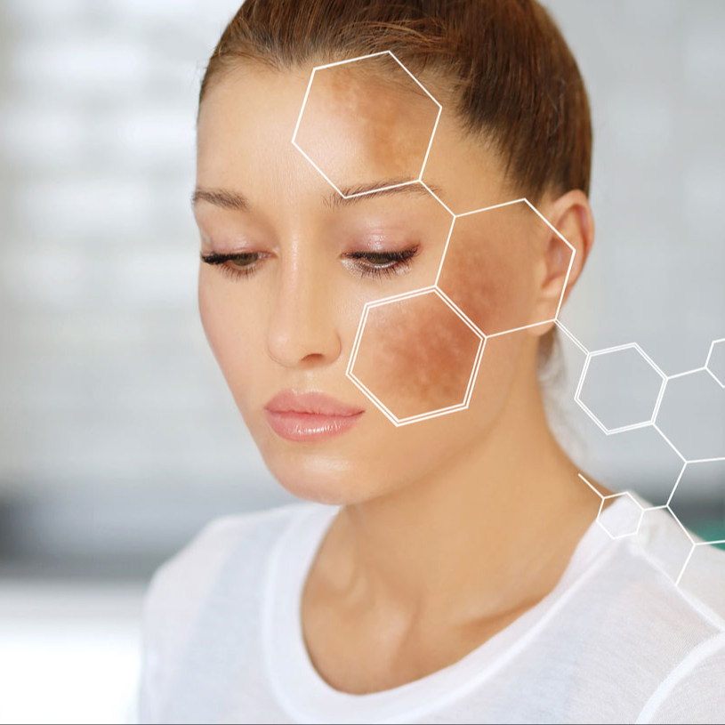 Trattamento macchie cutanee