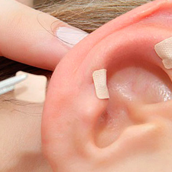 Auriculoterapia (Sessão Orelha).20⏱️