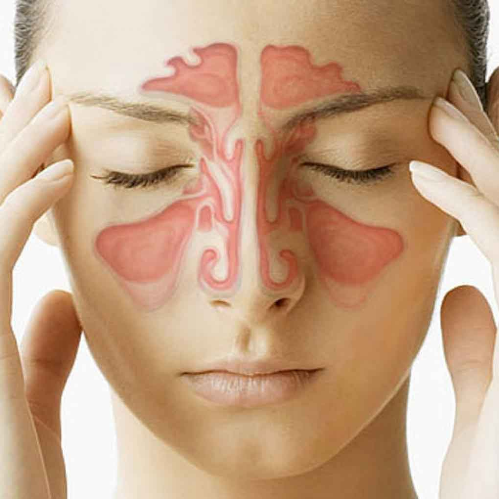 Sinusitis therapy 60 min