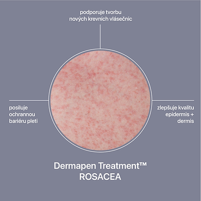 Dermapen Treatment™ Rosacea