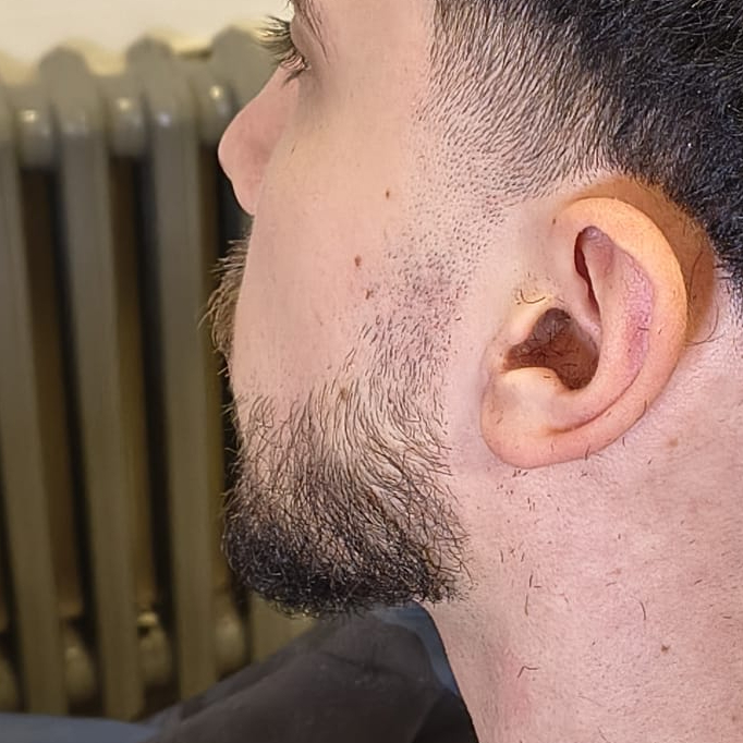 Beard trim