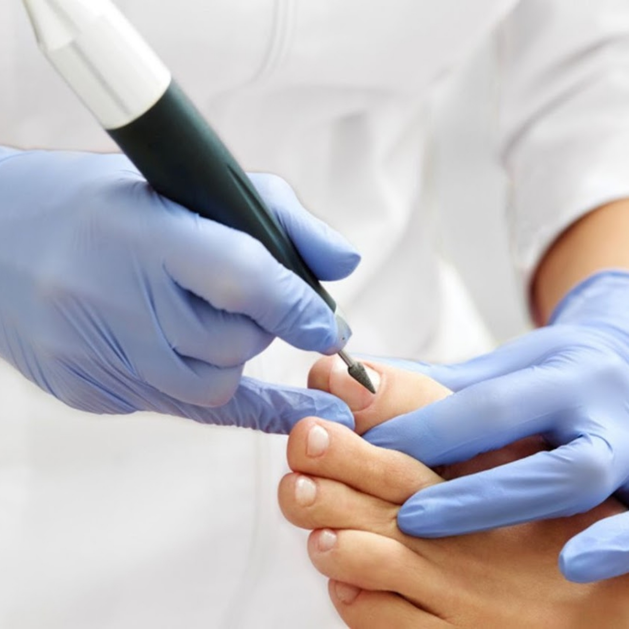 Medische pedicure