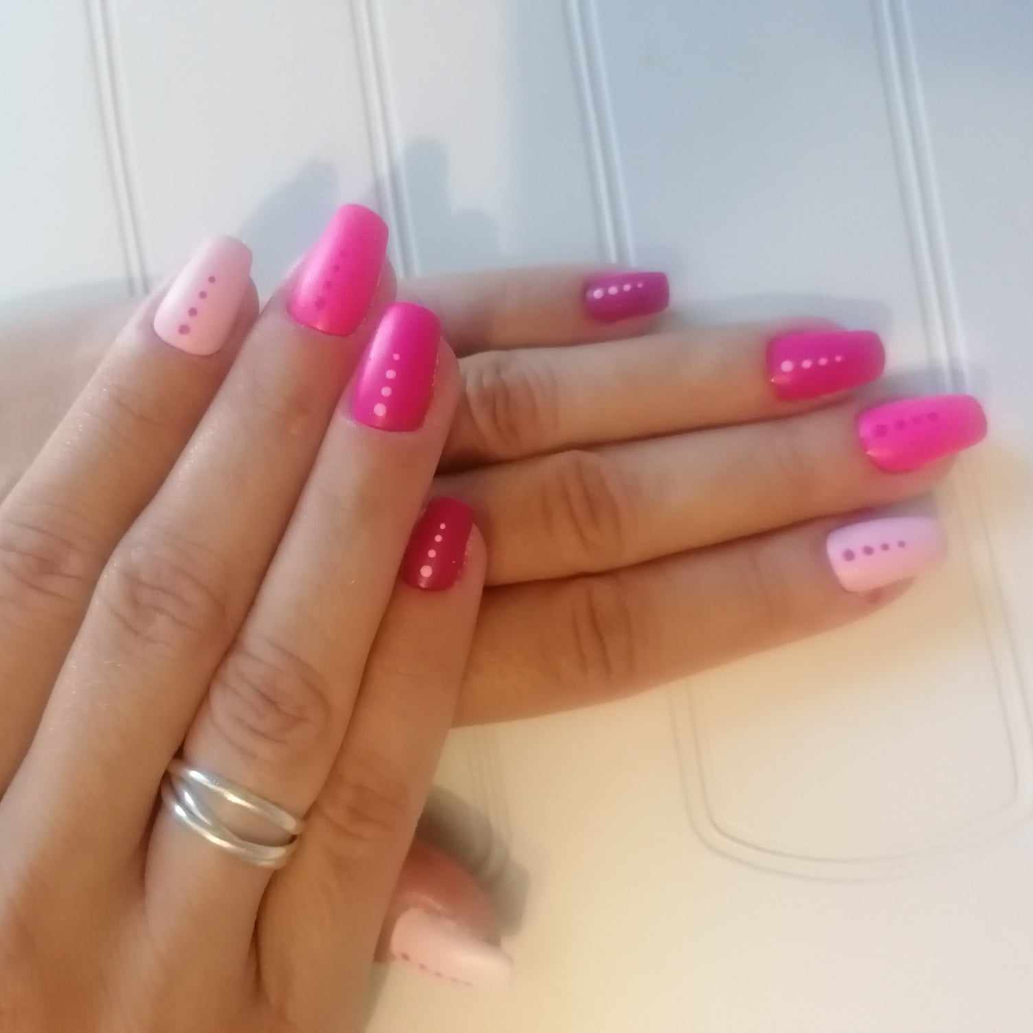 dépose d'une autre prothésiste  + pose semi permanent avec renfo