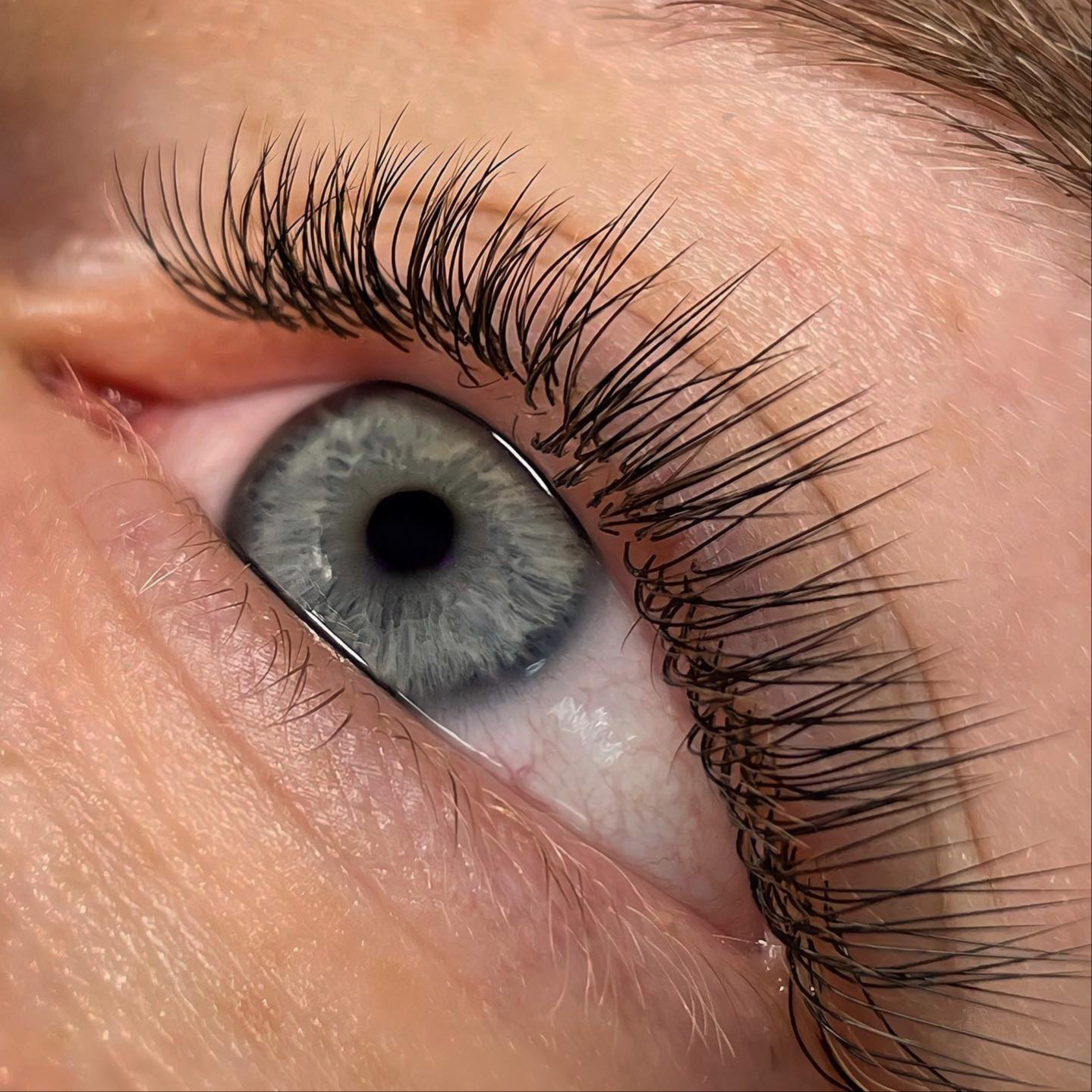 Doplnění řas 1,5D