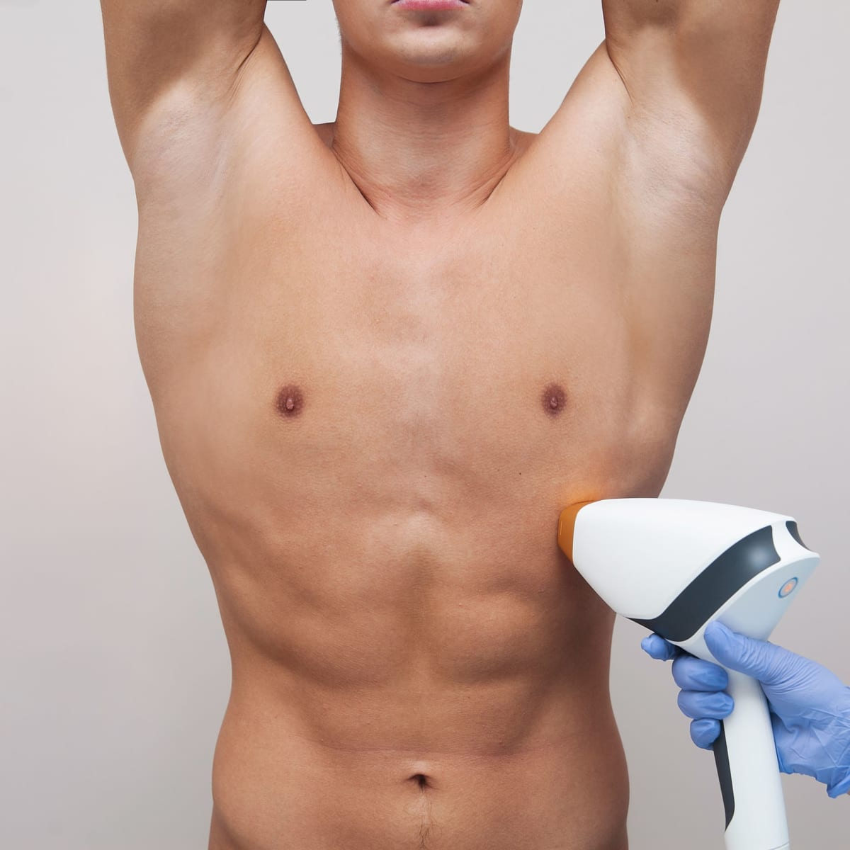 Depilação Laser SHR Corpo Completo (Homem)