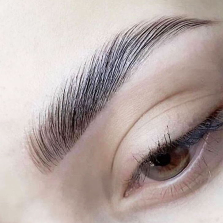 Restructuration + Épilation + Browlift