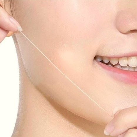 Kosmetický níťový lifting – kolagenové nitě 1 oblast