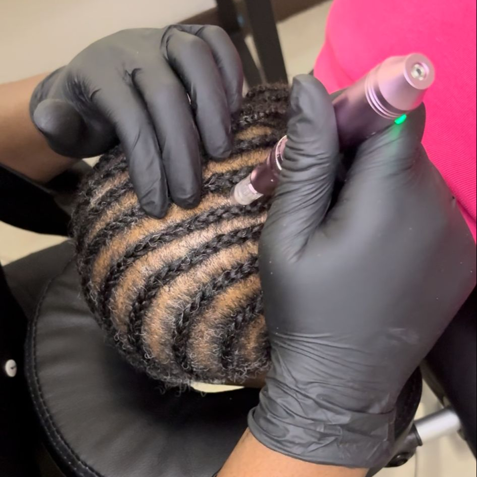 Hairneedling - Tête entière - Forfait 4 séances