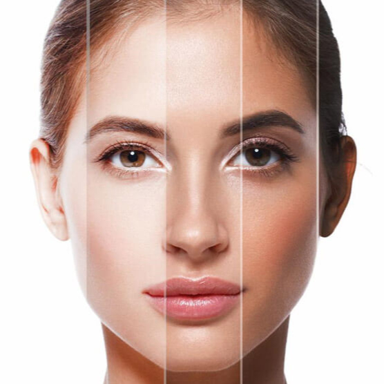 SMART sessão solario+colagéneo 12M