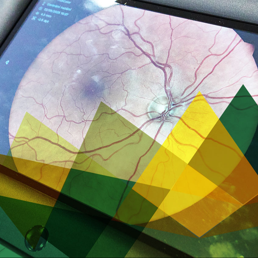 Komplexní biometrické vyšetření očí + AI screening kardio nemocí