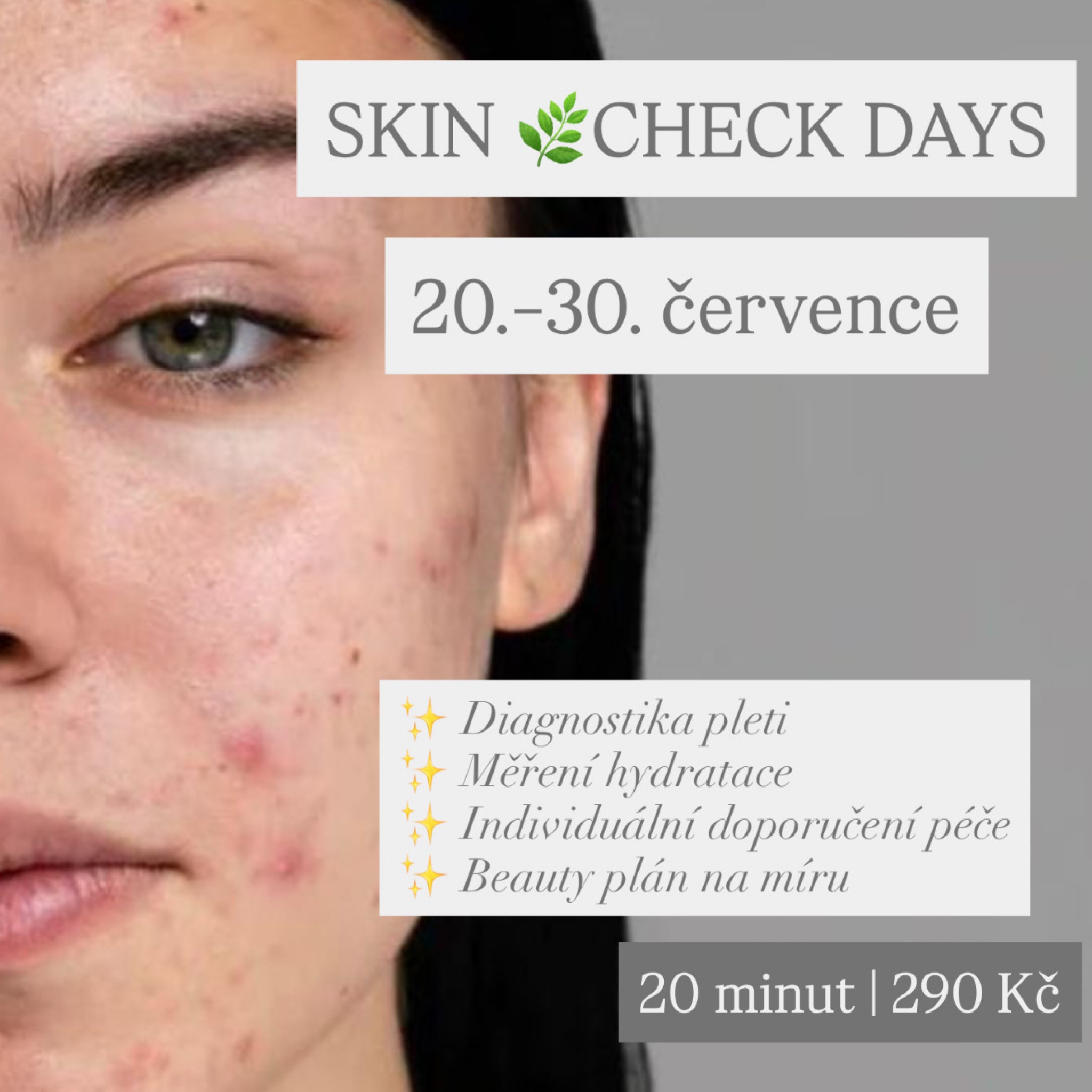 SKIN CHECK DAYS - zjisti jak na tom jsi!