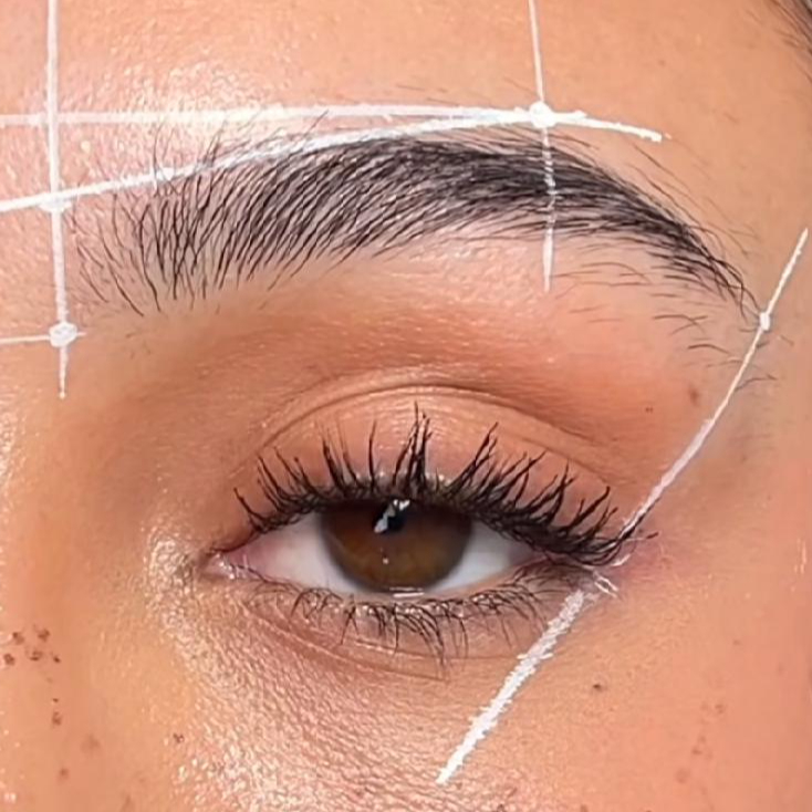 Restructuration simple