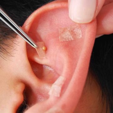 Ariculoterapia (Sessão Orelha).30m