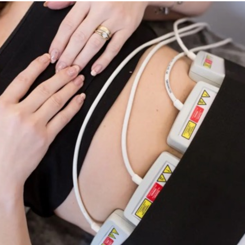 Lipo Laser
