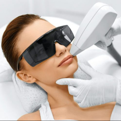 Depilação Laser SHR Buço