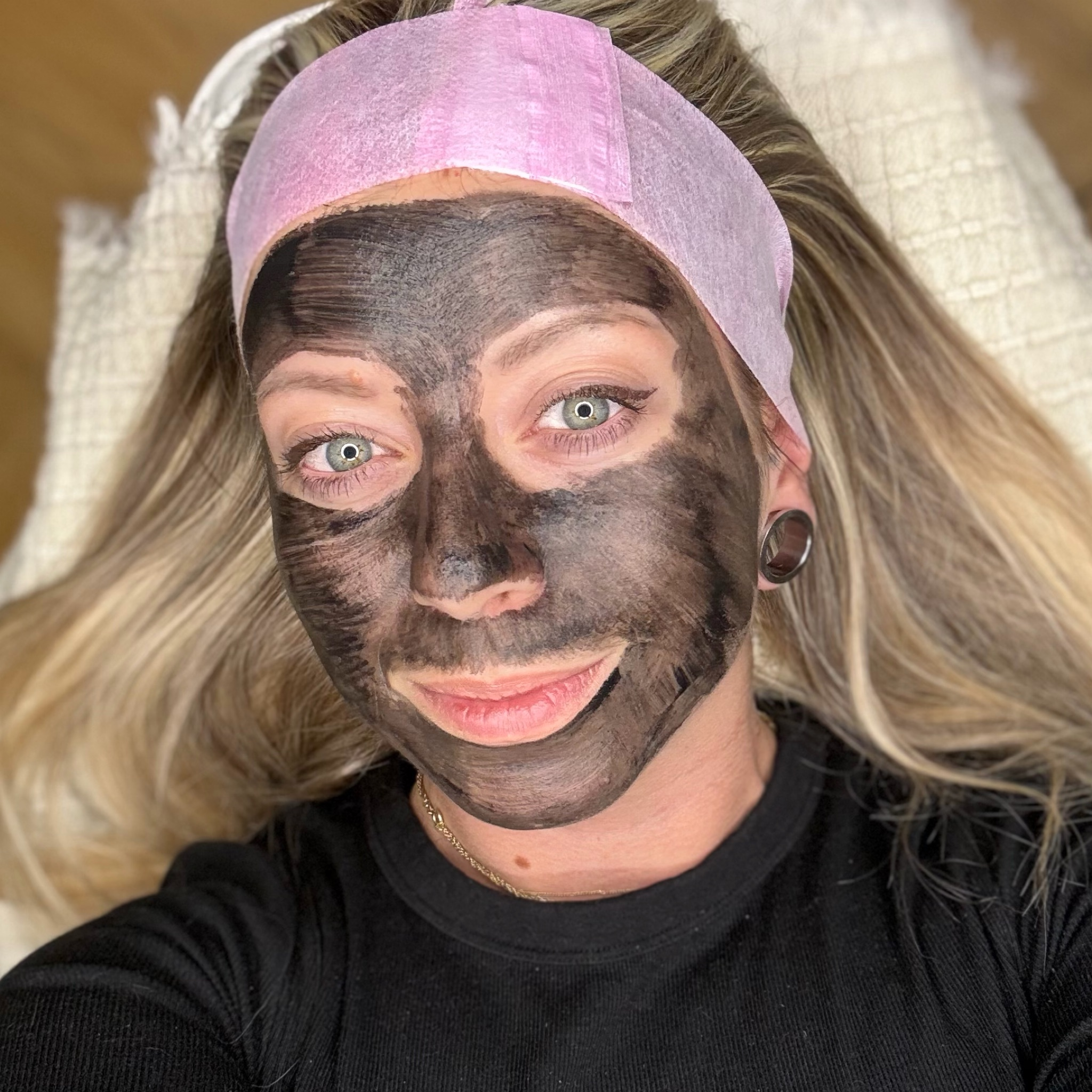 Carbon Peel 6 ošetření