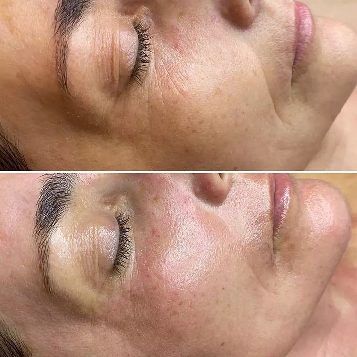 SKIN REPAIR | Obnova a zpevnění