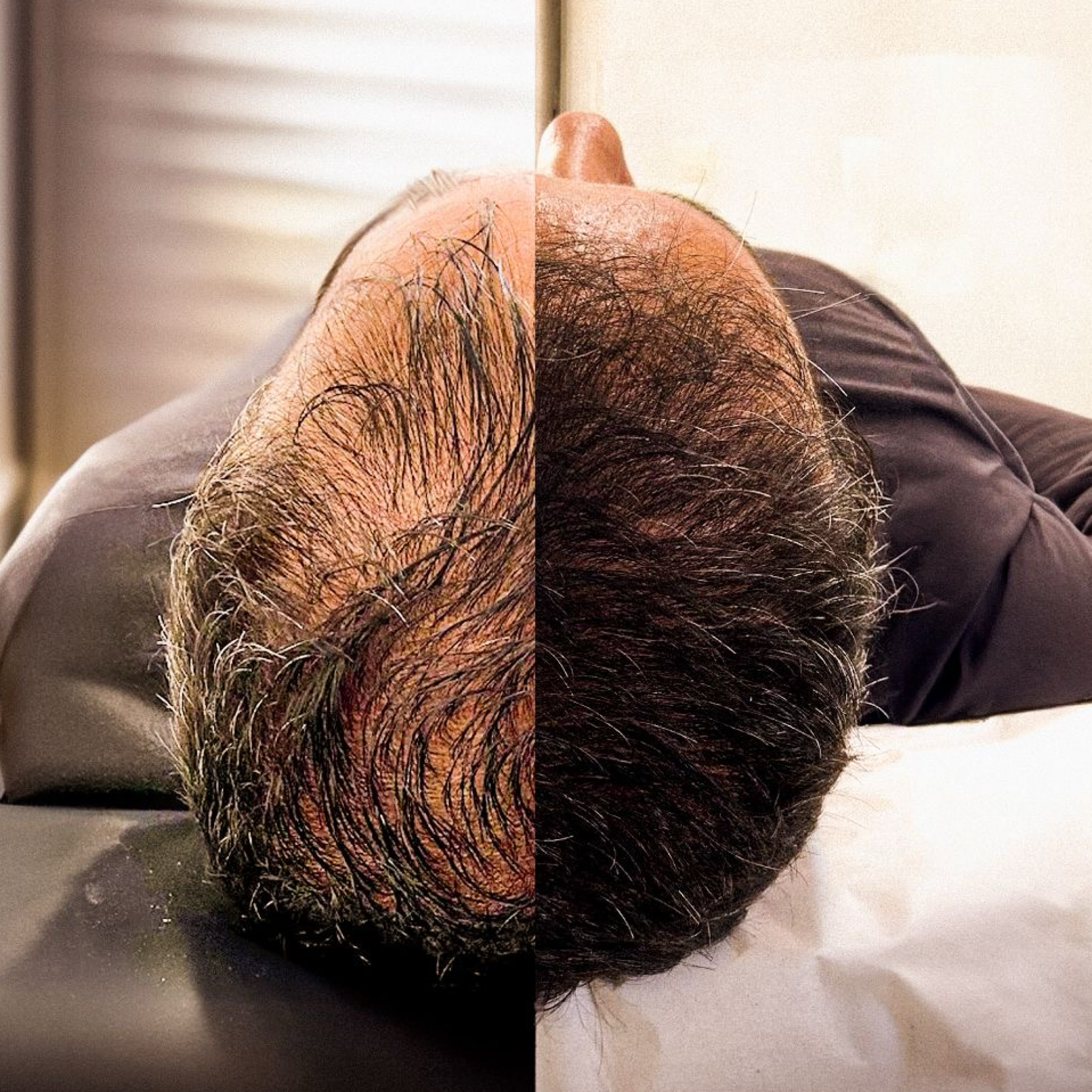 Hair Booster - Trichologie