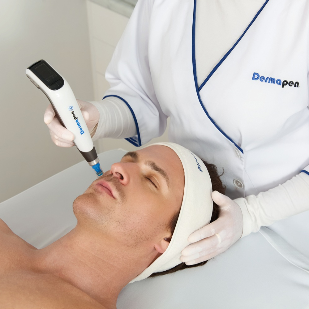 Microneedeling obličej & tělo / Face & Body