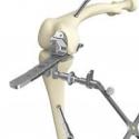Emeraude Chirugie Orthopédique
