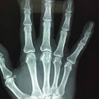 Imedicas Diagnosticas EU