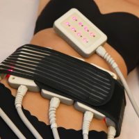 Lipolaser