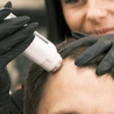 čištění vlasové pokožky + aplikace séra pomocí elektroporace