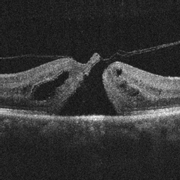 Retina Assessment