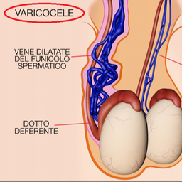 Doppler Testicolare (Scrotale) con Urologo