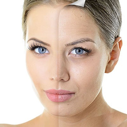 Forfait 5 traitements photorajeunissement  visage
